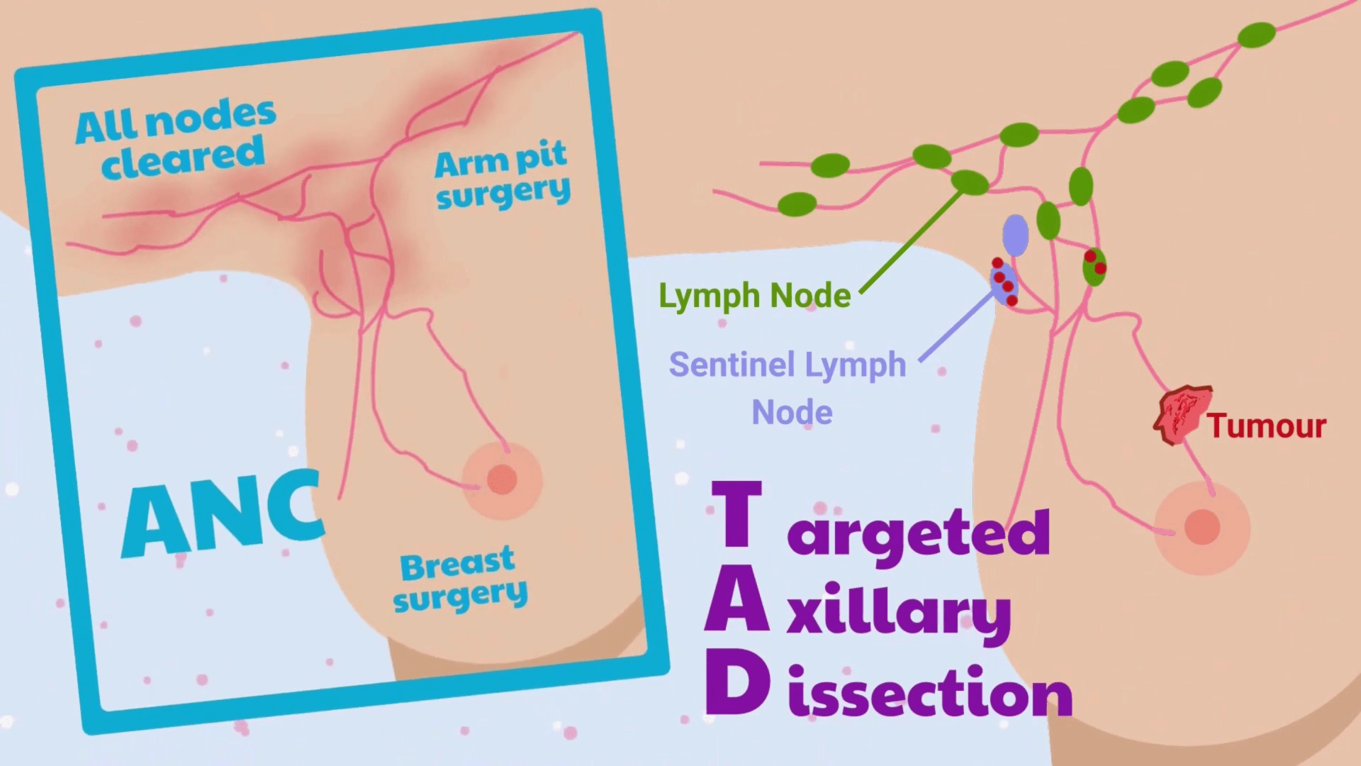 Diagram explaining the patient journey through the TADPOLE study