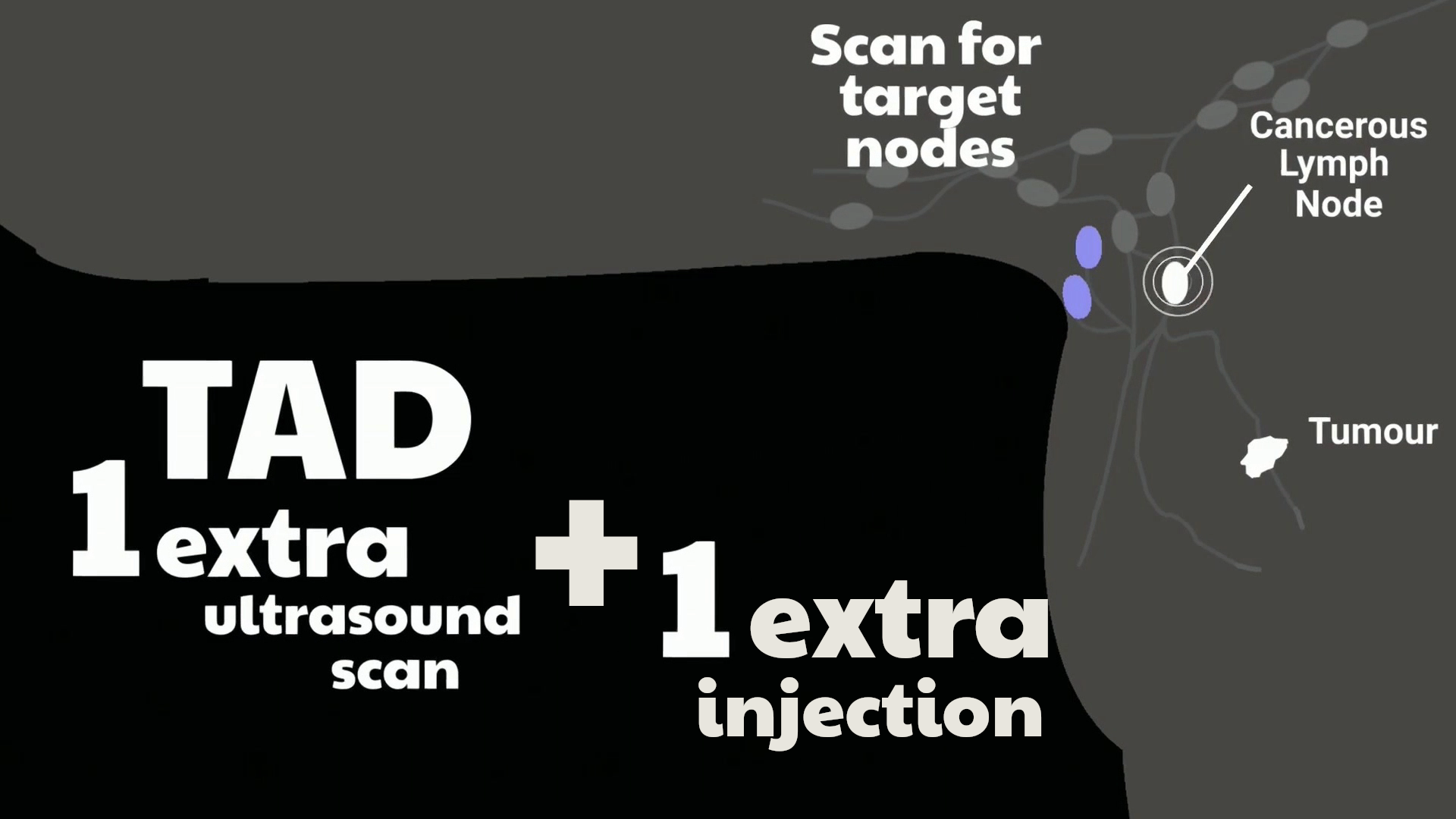 Illustration showing an extra ultrasound scan and injection